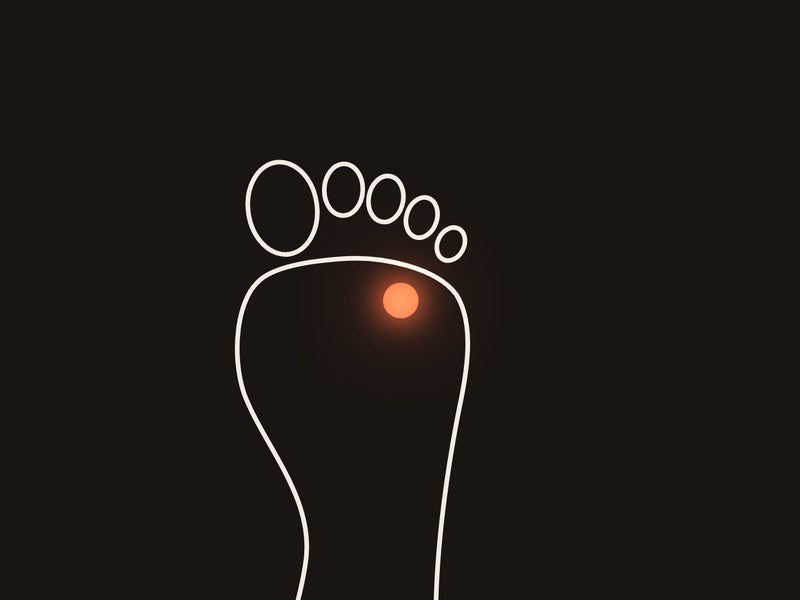 Morton's neuroma