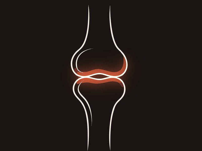 Knee osteoarthritis